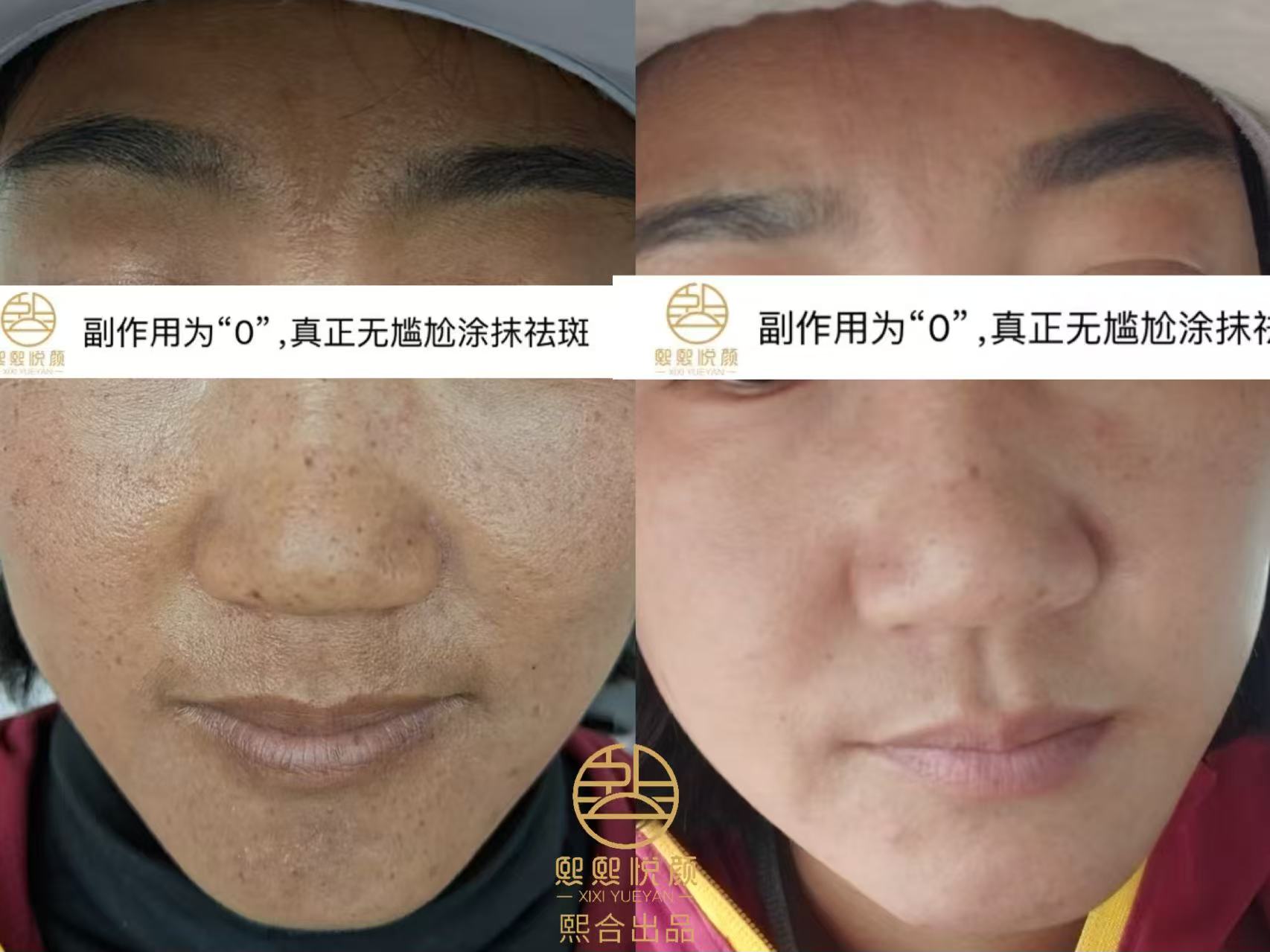 案例1.jpg
