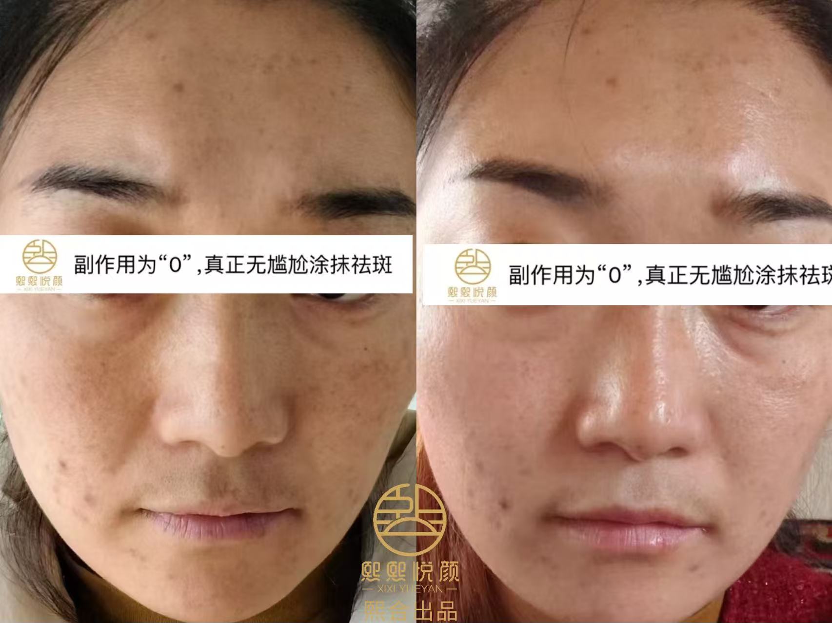 案例3.jpg