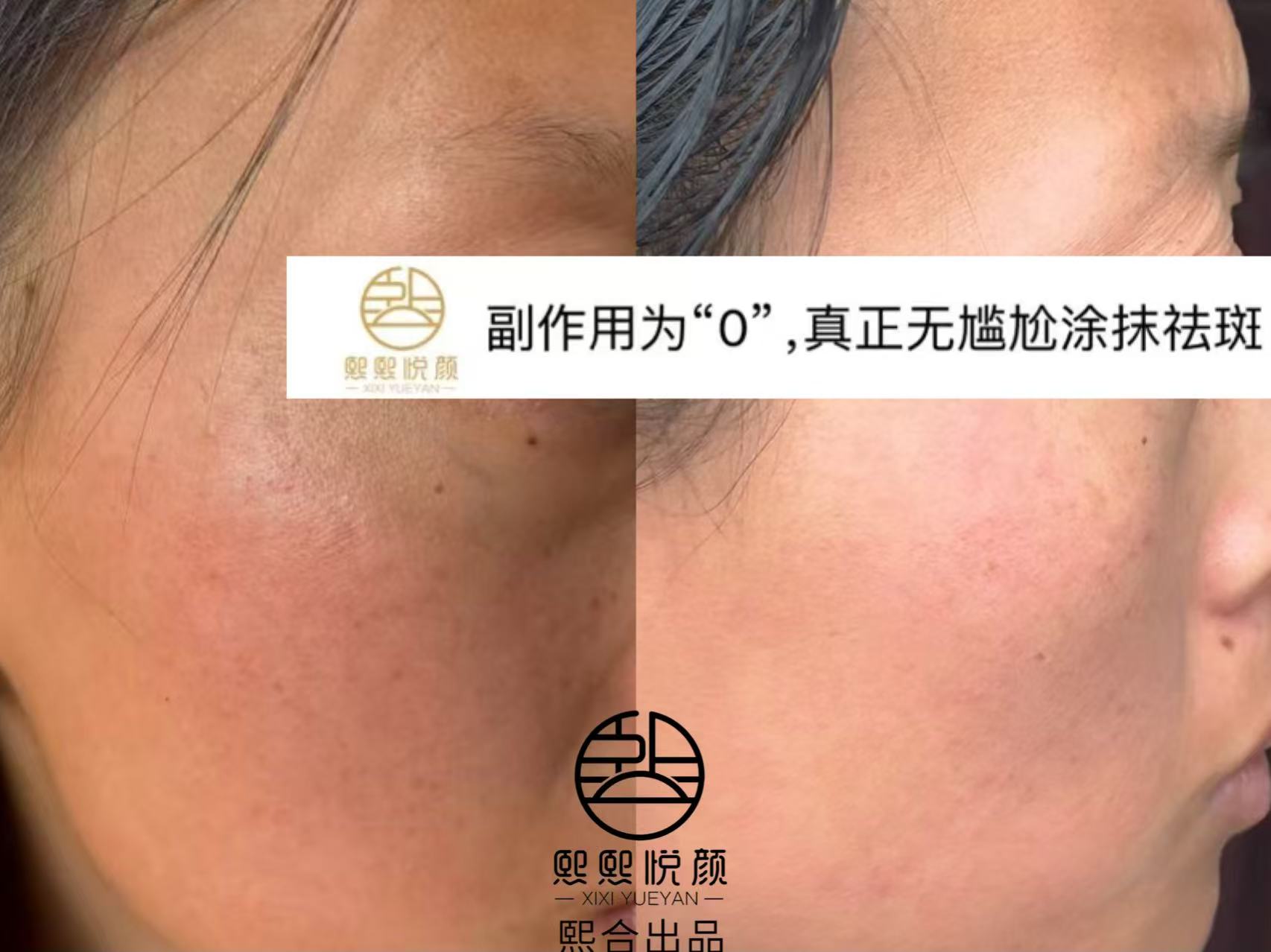 案例5.jpg